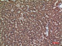 PSG1 Polyclonal Antibody