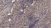 PSMC3 Polyclonal Antibody