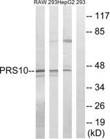 PSMC6 Polyclonal Antibody