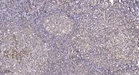 PHF1 Polyclonal Antibody