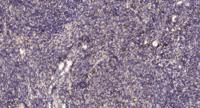 PHKA1/2 Polyclonal Antibody