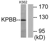 PHKB Polyclonal Antibody