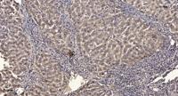 PHKG1 Polyclonal Antibody