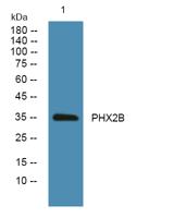 PHX2B Polyclonal Antibody