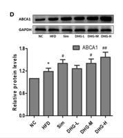 ABCA1 Polyclonal Antibody