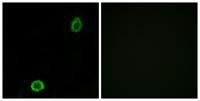 ABCA13 Polyclonal Antibody