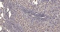 ABCAC Polyclonal Antibody