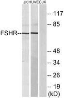 FSHR Polyclonal Antibody