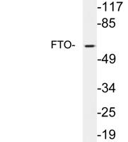 FTO Polyclonal Antibody