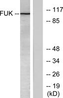 Fucokinase Polyclonal Antibody