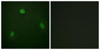 Pin1 Polyclonal Antibody