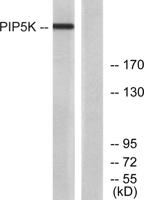 PIP5KIII Polyclonal Antibody