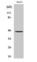 PDK2 Polyclonal Antibody