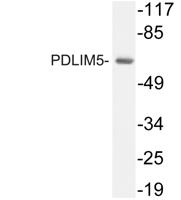 PDLIM5 Polyclonal Antibody