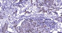 PDLIM5 Polyclonal Antibody