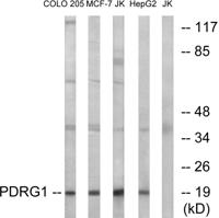 PDRG1 Polyclonal Antibody