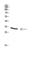 PENK Polyclonal Antibody