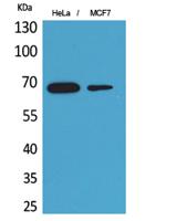 PEPCK-C Polyclonal Antibody