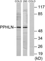 Periphilin 1 Polyclonal Antibody