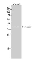 Peropsin Polyclonal Antibody