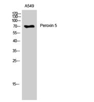 Peroxin 5 Polyclonal Antibody