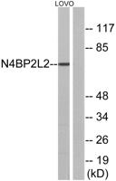 PFAAP5 Polyclonal Antibody