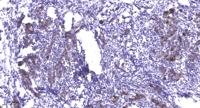 PFK-2 liv/tes Polyclonal Antibody