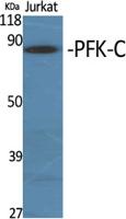 PFK-C Polyclonal Antibody