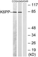 PFK-C Polyclonal Antibody