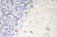 PFKM Polyclonal Antibody