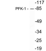 PFKM Polyclonal Antibody