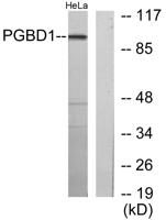 PGBD1 Polyclonal Antibody