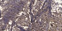 PBEF Polyclonal Antibody