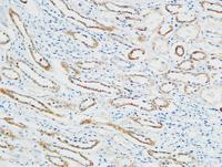 PBF Polyclonal Antibody