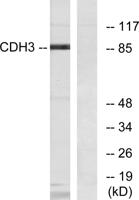 P-cadherin Polyclonal Antibody