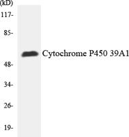 P-cadherin Polyclonal Antibody