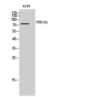 PDE10A Polyclonal Antibody