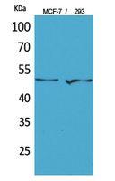 PD-ECGF Polyclonal Antibody