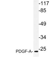 PDGF-A Polyclonal Antibody