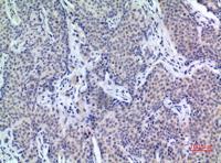 PDGF-D Polyclonal Antibody