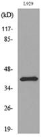 PDGF-D Polyclonal Antibody