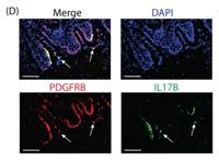 PDGFR-β Polyclonal Antibody