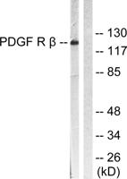 PDGFR-β Polyclonal Antibody