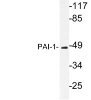 PAI-1 Polyclonal Antibody