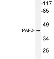 PAI-2 Polyclonal Antibody