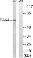 PAK4/5/6 Polyclonal Antibody