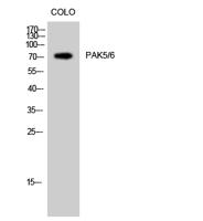 PAK5/6 Polyclonal Antibody