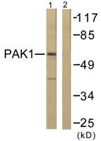 PAKα Polyclonal Antibody