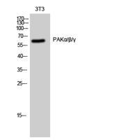 PAKα/β/γ Polyclonal Antibody