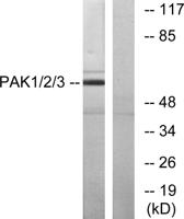 PAKα/β/γ Polyclonal Antibody